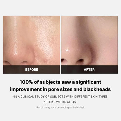 Zero Pore Pads (70 pads)