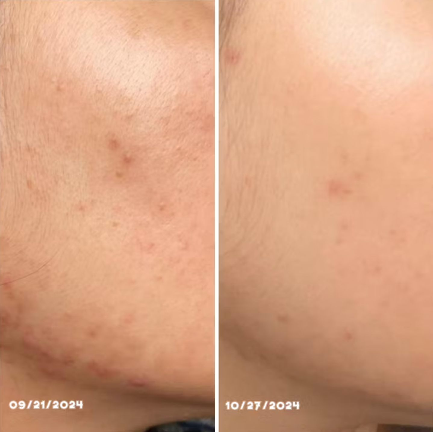 Numbuzin - No.1 Pantothenic B5 Active Soothing Cream (80ml) - v7 - Seoulful Skincare