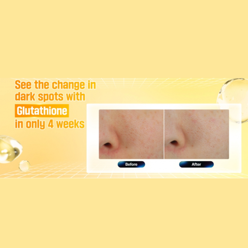 Numbuzin - No.5+ Vitamin Glutathione Dark Spot Laser (50ml) - Seoulful Skincare Numbuzin - No.5+ Vitamin Glutathione Dark Spot Laser (50ml) - Seoulful Skincare