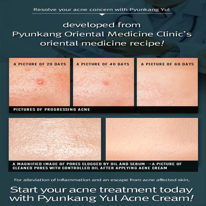Pyunkang_Yul_-_ACNE_Cream_50ml_Info4_Seoulful_Skincare