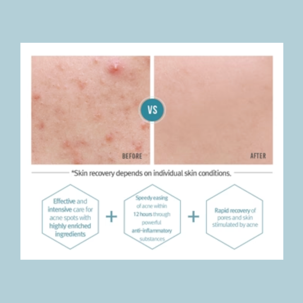 Pyunkang_Yul_-_ACNE_Spot_Cream_15ml_Info4-_Seoulful_Skincare