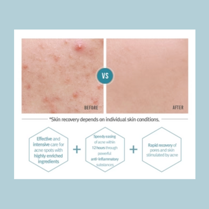 Pyunkang_Yul_-_ACNE_Spot_Cream_15ml_Info4-_Seoulful_Skincare