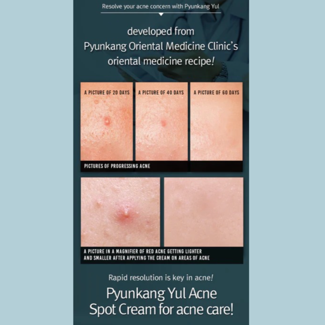 Pyunkang_Yul_-_ACNE_Spot_Cream_15ml_Info6-_Seoulful_Skincare