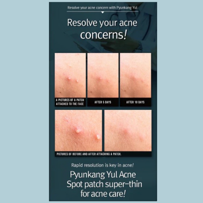 Pyunkang Yul - ACNE Spot Patch Super Thin (15 Patches) Info8- Seoulful Skincare