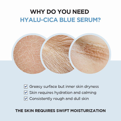 Madagascar Centella Hyalu-Cica Blue Serum (30ml/50ml)
