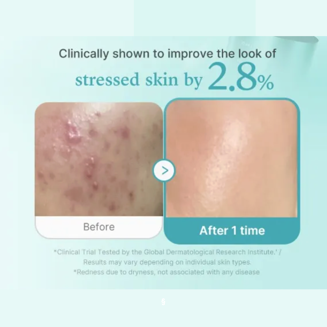 Medicube - Azelaic Acid Exosome Shot 2000 (30ml) - v8 - Seoulful Skincare